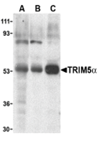 AP30952PU-N - TRIM5 / RNF88
