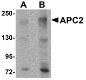 AP30058PU-N - APC2