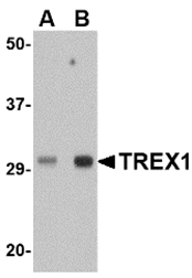 AP30942PU-N - TREX1