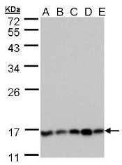 AP19062PU-N - PPP3R1 / Calcineurin B
