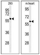 AP15246PU-N - Protein phosphatase 1G / PPM1G