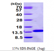 AR09561PU-N - Beta-2-microglobulin