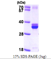 AR09570PU-L - NUDT5