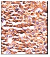 AP15290PU-N - PPP2CA / PPP2CB