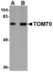 AP30930PU-N - TOMM70A