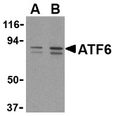 AP30088PU-N - ATF6 alpha