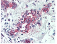 AM20162SU-N - Cytokeratin 1