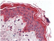 AM20162SU-N - Cytokeratin 1