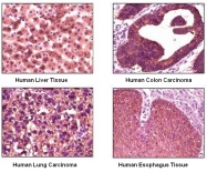 AM20162SU-N - Cytokeratin 1