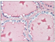 BM733 - Thyroglobulin