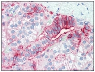 SM3153P - CD44