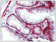 SM3153P - CD44