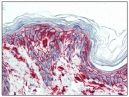 SM3153P - CD44