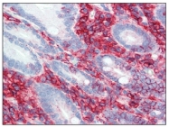 SM3153P - CD44