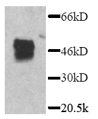TP401 - GFP