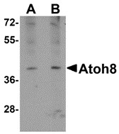 AP30095PU-N - ATOH8