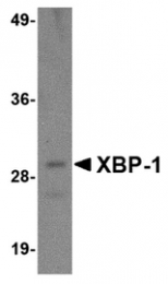 AM20144PU-N - XBP1 / TREB5