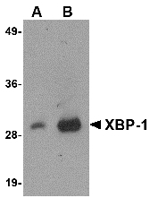 AM20145PU-N - XBP1 / TREB5