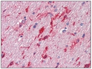 AM20164PU-N - Hepatocyte growth factor / HGF