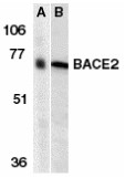 AP30112PU-N - BACE2