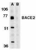 AP30113PU-N - BACE2