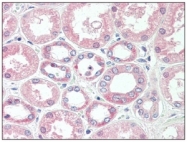 AM01230PU-N - Superoxide Dismutase 1 / SOD1