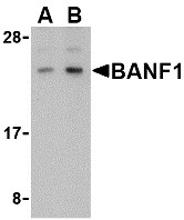AP30118PU-N - BANF1