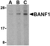 AP30119PU-N - BANF1