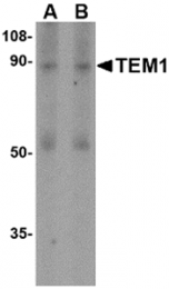 AP30867PU-N - CD248 / TEM1