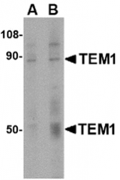AP30866PU-N - CD248 / TEM1