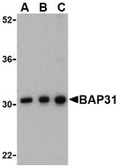 AP30123PU-N - BCAP31 / BAP31