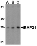 AP30124PU-N - BCAP31 / BAP31
