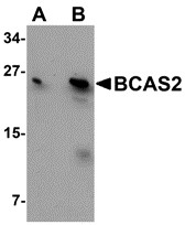AP30126PU-N - BCAS2 / DAM1