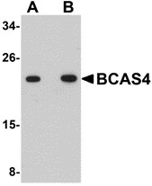 AP30127PU-N - BCAS4