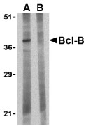 AP30130PU-N - Bcl-2-like 10