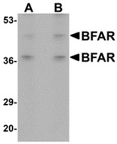 AP30141PU-N - BFAR / RNF47