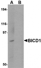 AP30144PU-N - BICD1