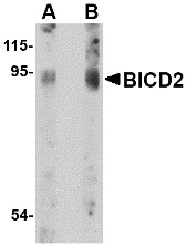 AP30145PU-N - BICD2