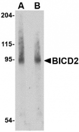 AP30146PU-N - BICD2
