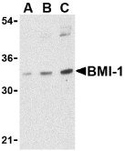 AP30158PU-N - BMI-1 / RNF51