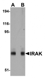 AM20155PU-N - IRAK1