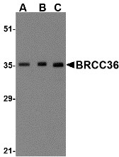 AP30164PU-N - BRCC3