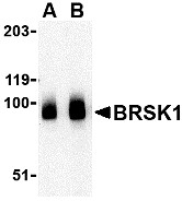 AP30166PU-N - BRSK1