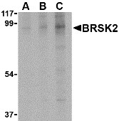 AP30168PU-N - BRSK2