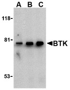 AP30170PU-N - BTK