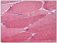 AM09080PU-N - Myosin light chain 2 (MYL2)