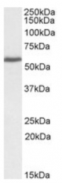 AP20107PU-N - PRPF31
