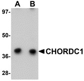 AP30227PU-N - CHORDC1