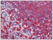 AM09088PU-N - G6PD