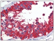 AM09088PU-N - G6PD